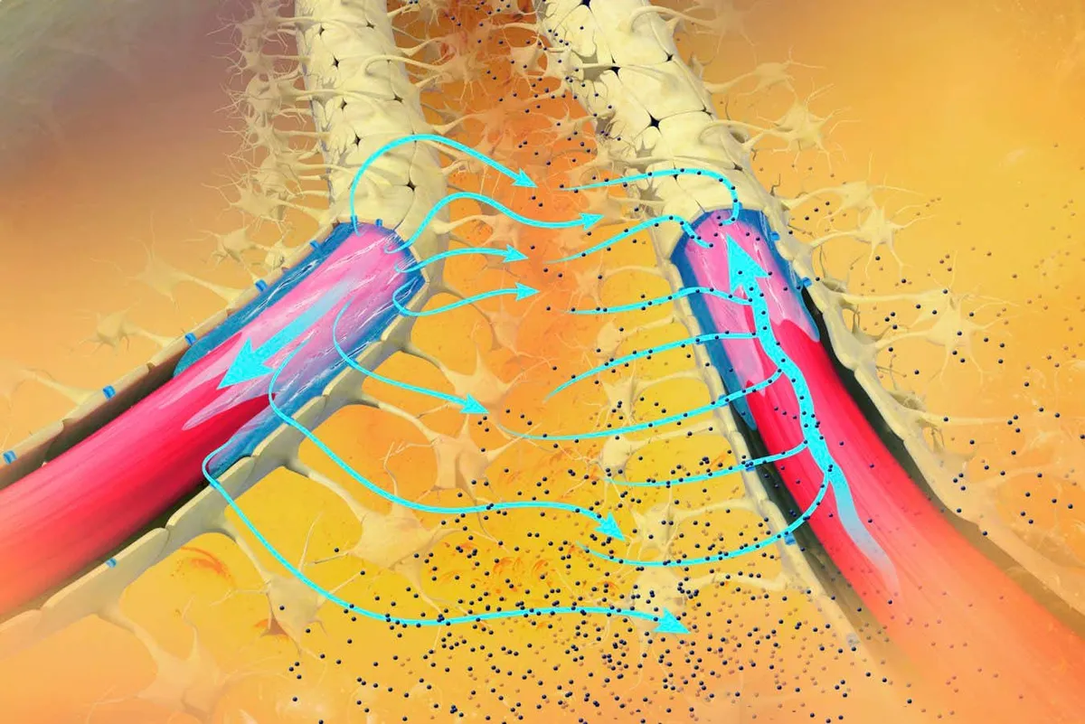 Doorbraak bij behandeling van Alzheimer’s Disease